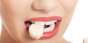 bawang a