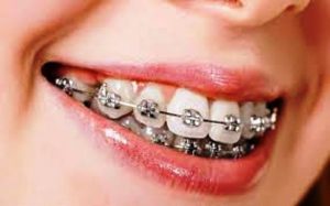 BEHEL A